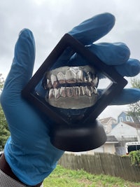 a person is holding a pair of silver teeth in a box